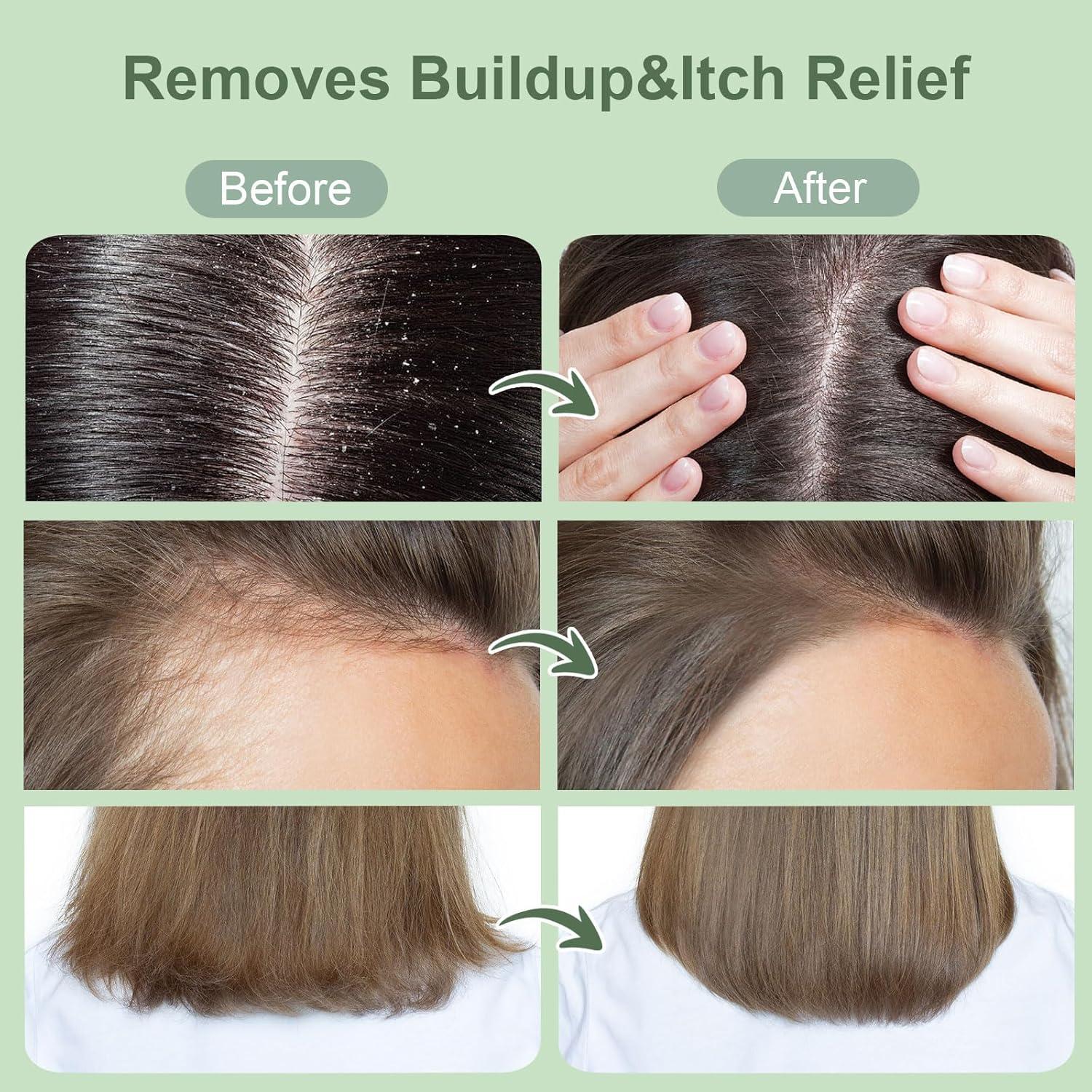 Exfoliante para Cuero Cabelludo ZENGYQI con Romero y Menta 300g