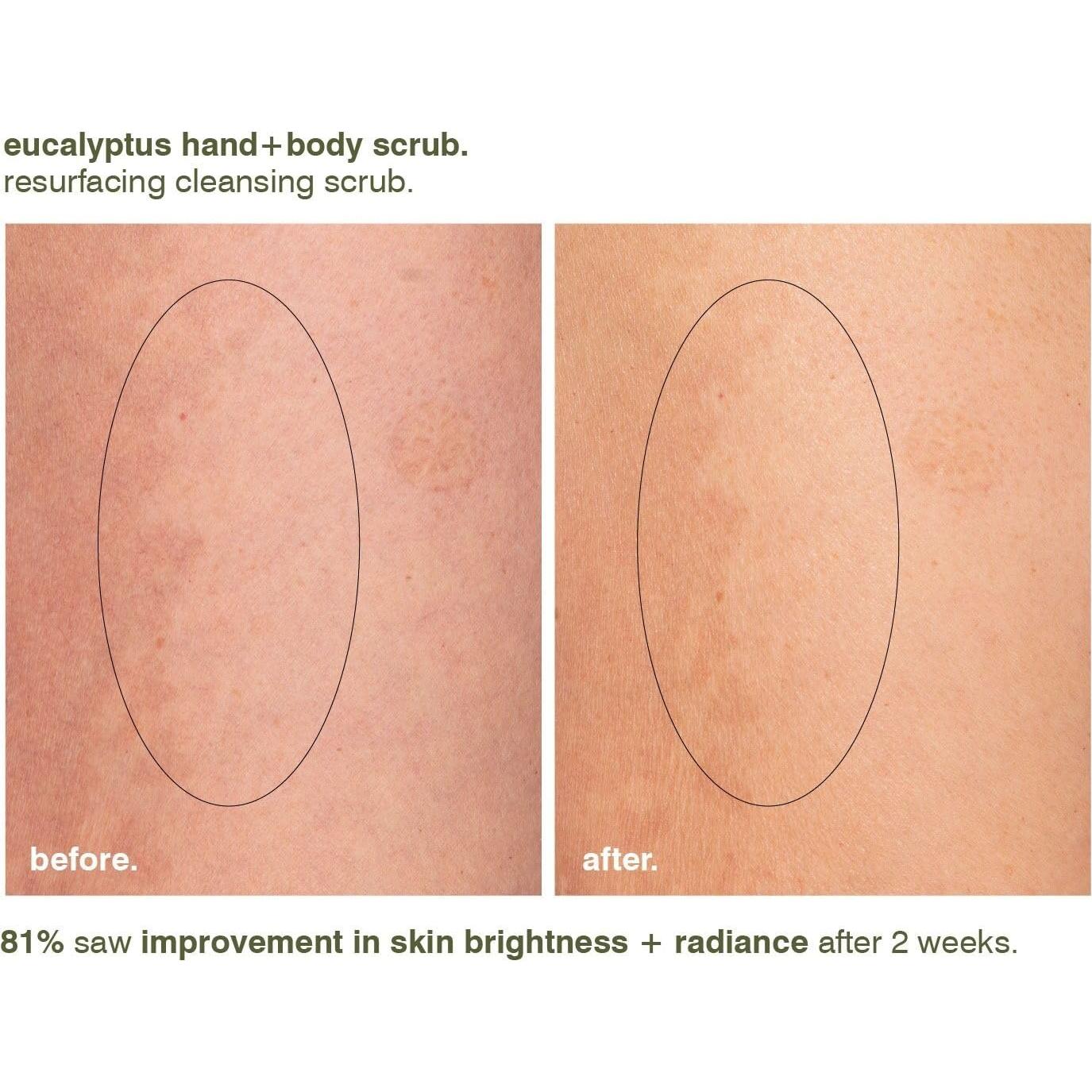 Exfoliante de Mano y Cuerpo Eucalipto Malin + Goetz 255g