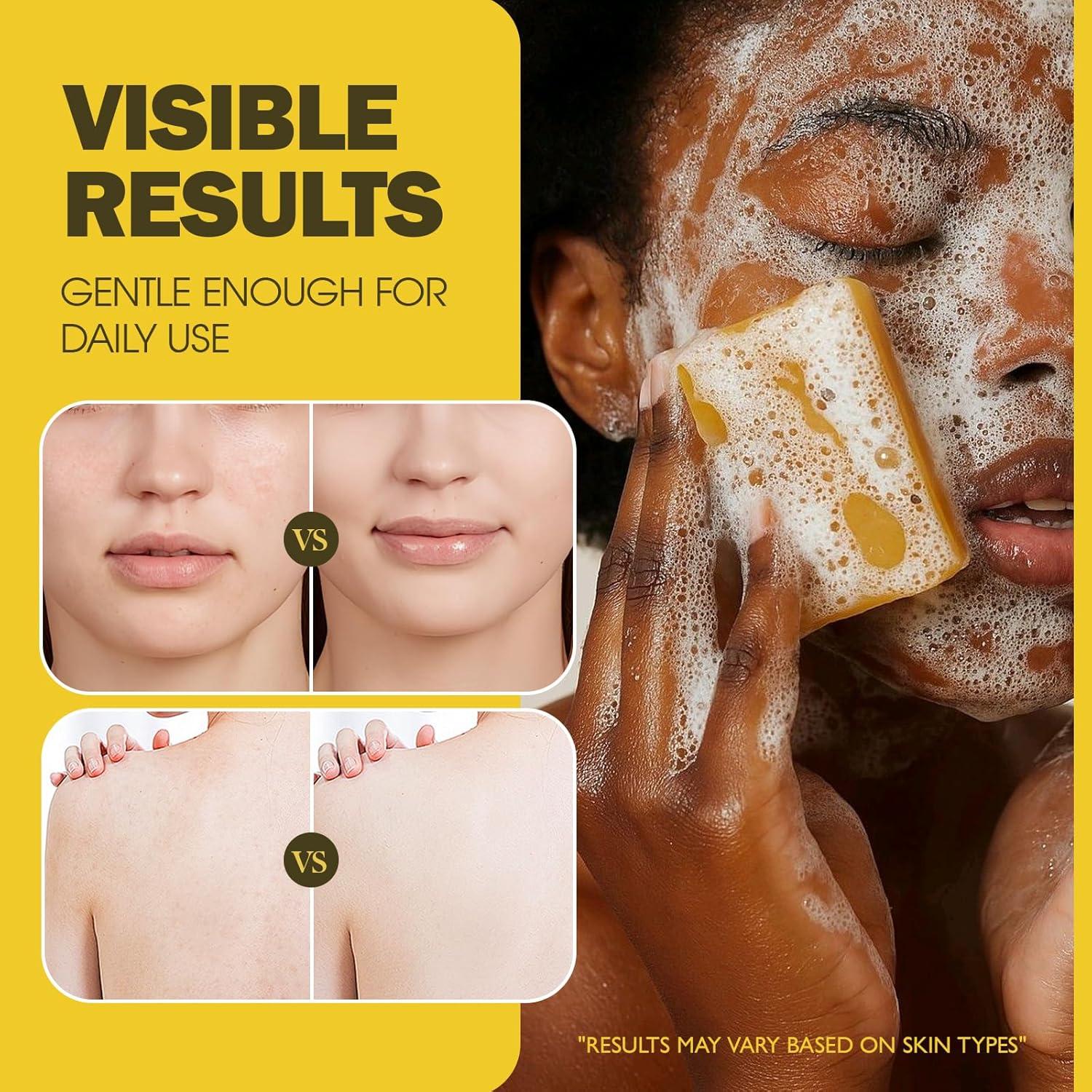 Jabón Aclarador Uselective con Ácido Kójico y Vitamina C - 131g