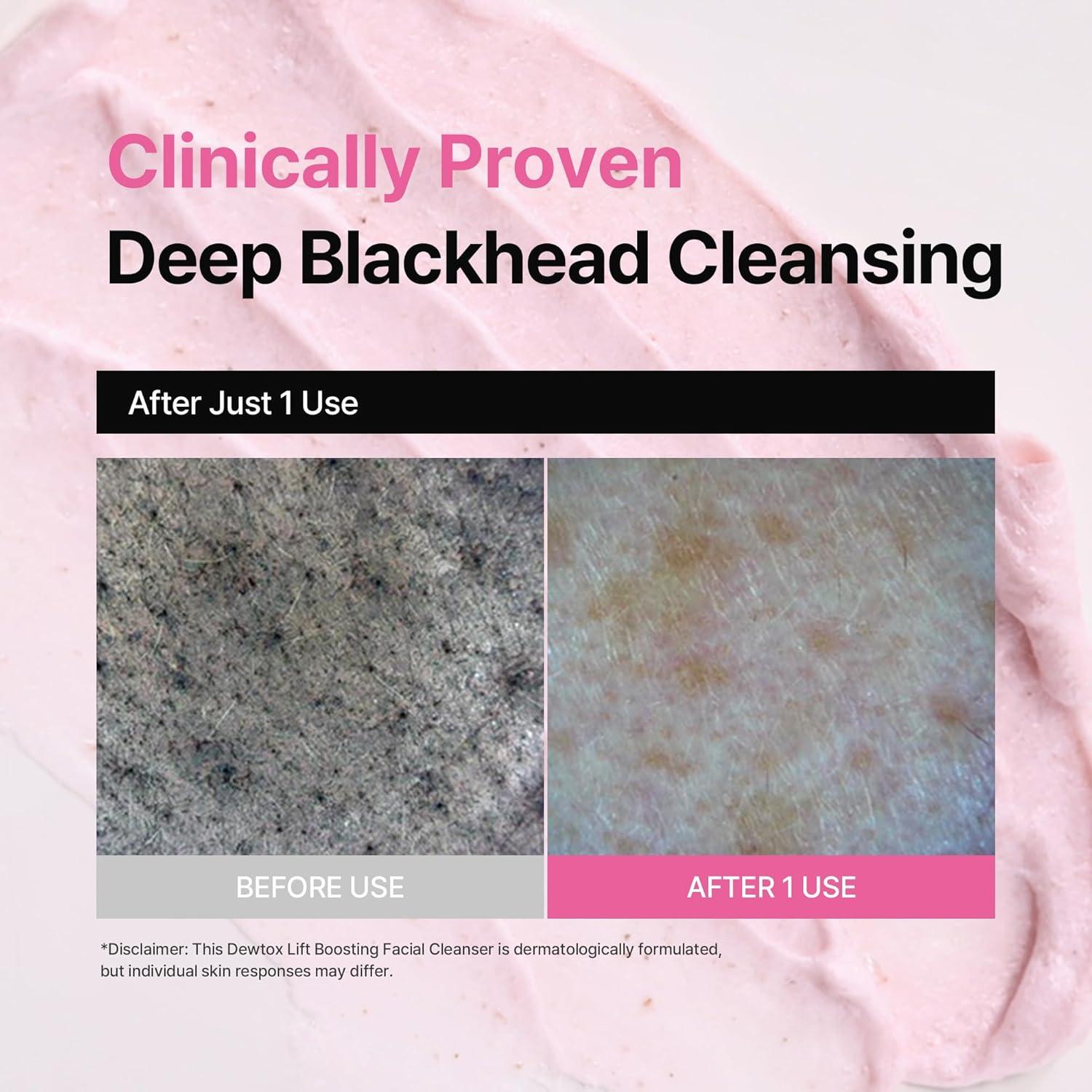 Limpiador Facial Espumoso Dewtox Lift 150ml - Piel Sensible