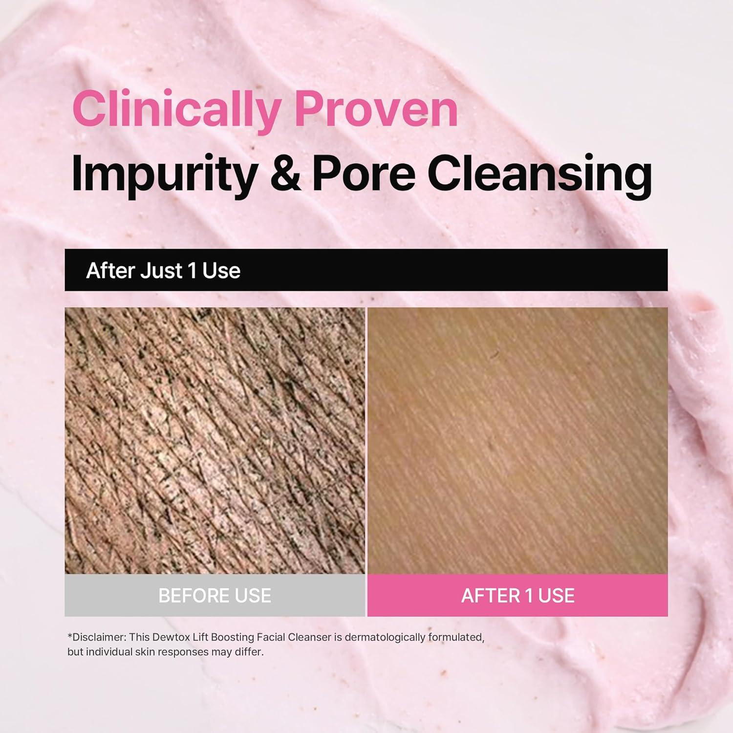 Limpiador Facial Espumoso Dewtox Lift 150ml - Piel Sensible