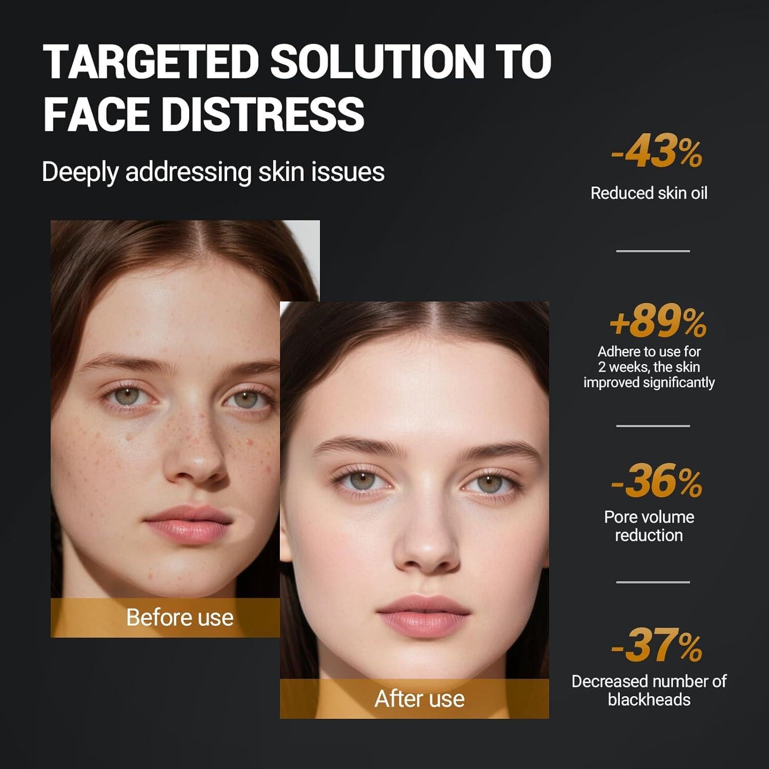 Mascarilla Facial de Arcilla Kaolin LANGULLCI 298g - Control de Aceite y Puntos Negros