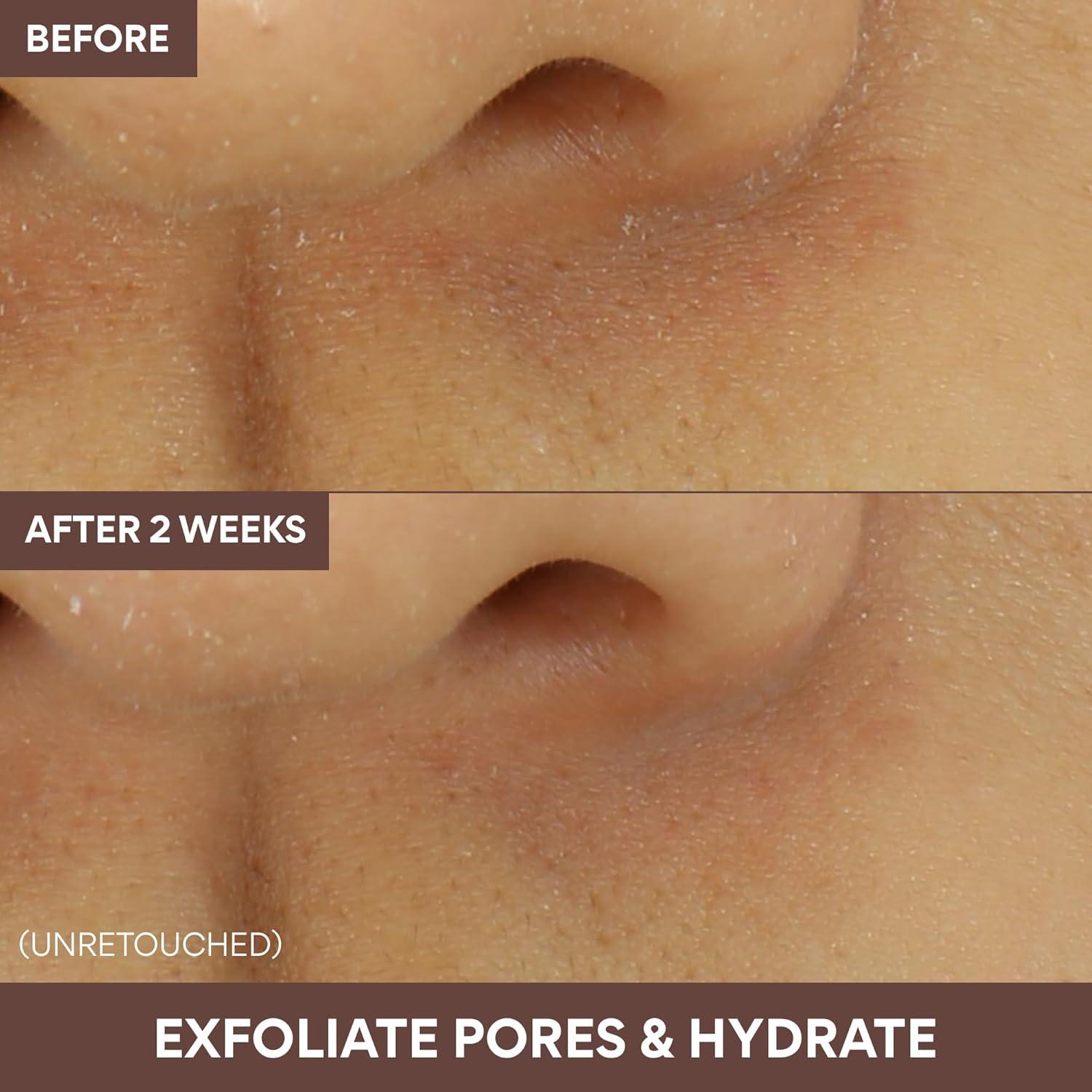 Mascarilla de Arcilla Super Volcánica Innisfree 109.73 g - Cuidado Piel