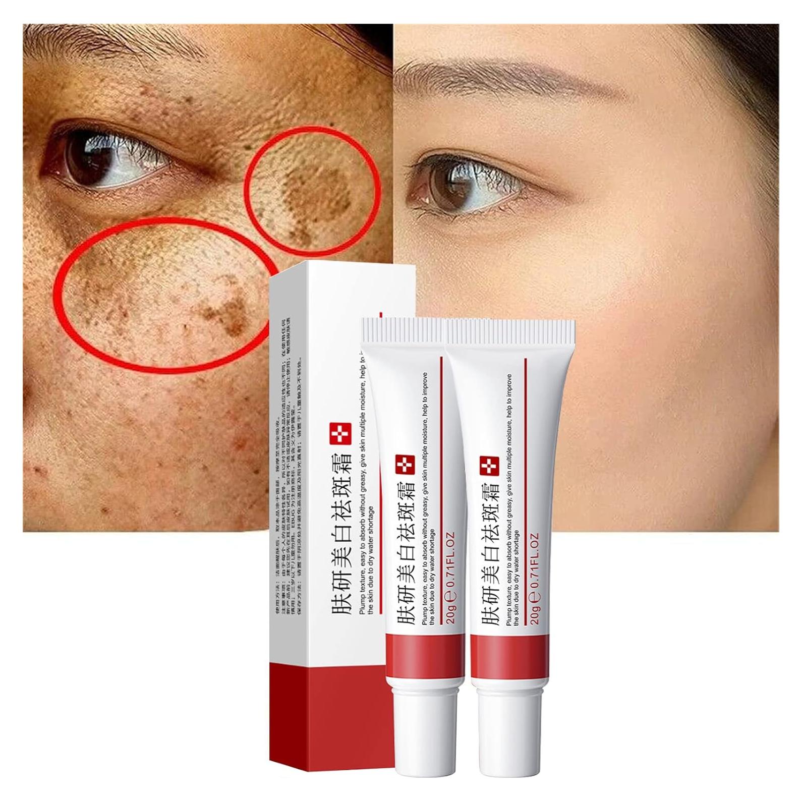 Crema Blanqueadora Fupah para Pecas y Cicatrices 32g