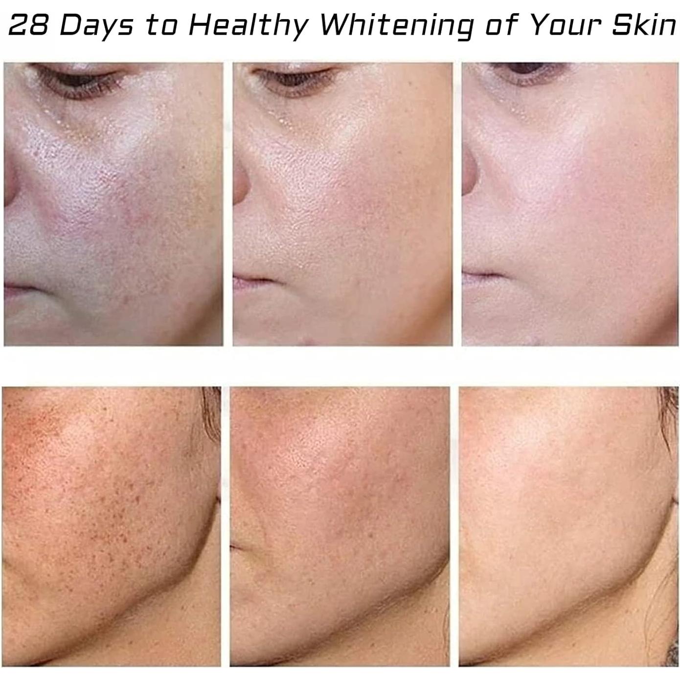 Crema Blanqueadora Fupah para Pecas y Cicatrices 32g