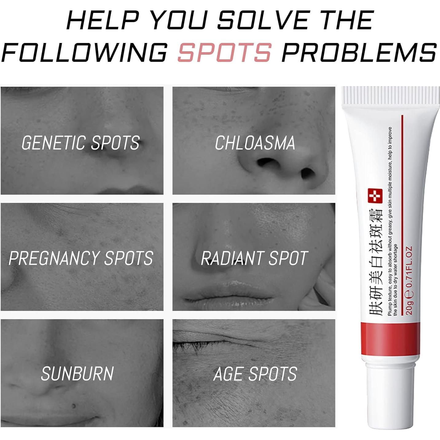 Crema Blanqueadora Fupah para Pecas y Cicatrices 32g