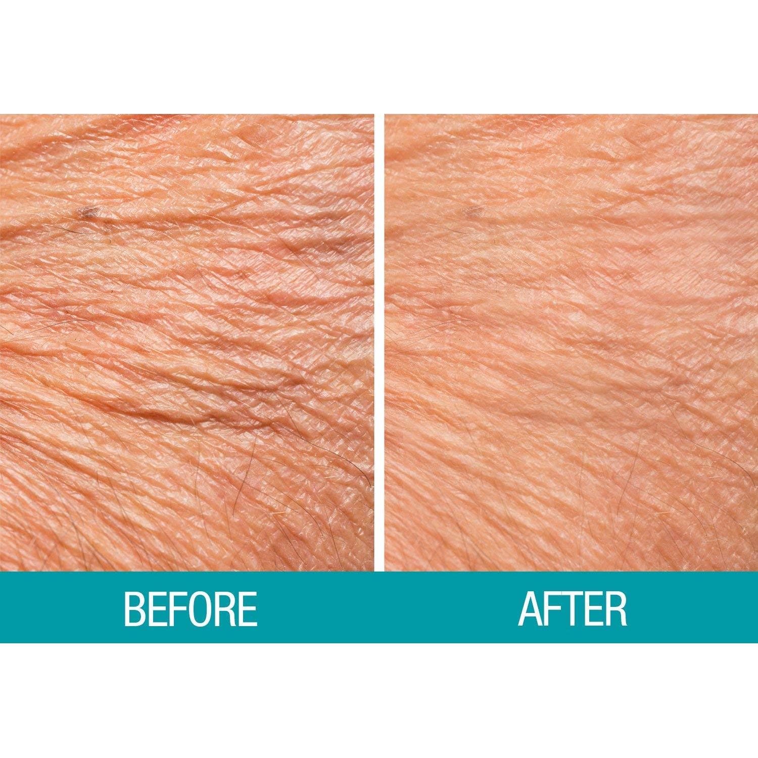 Crema Corporal Souffle Dermactin 340g Hidratante Piel Crepé