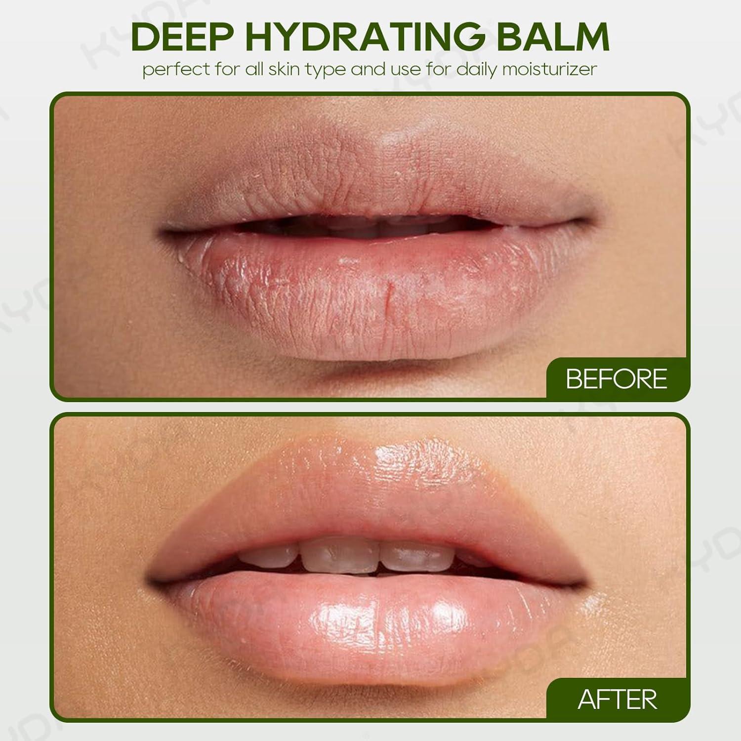 Bálsamo Labial Hidratante KYDA Aloe Vera 3 Pcs 2.7g