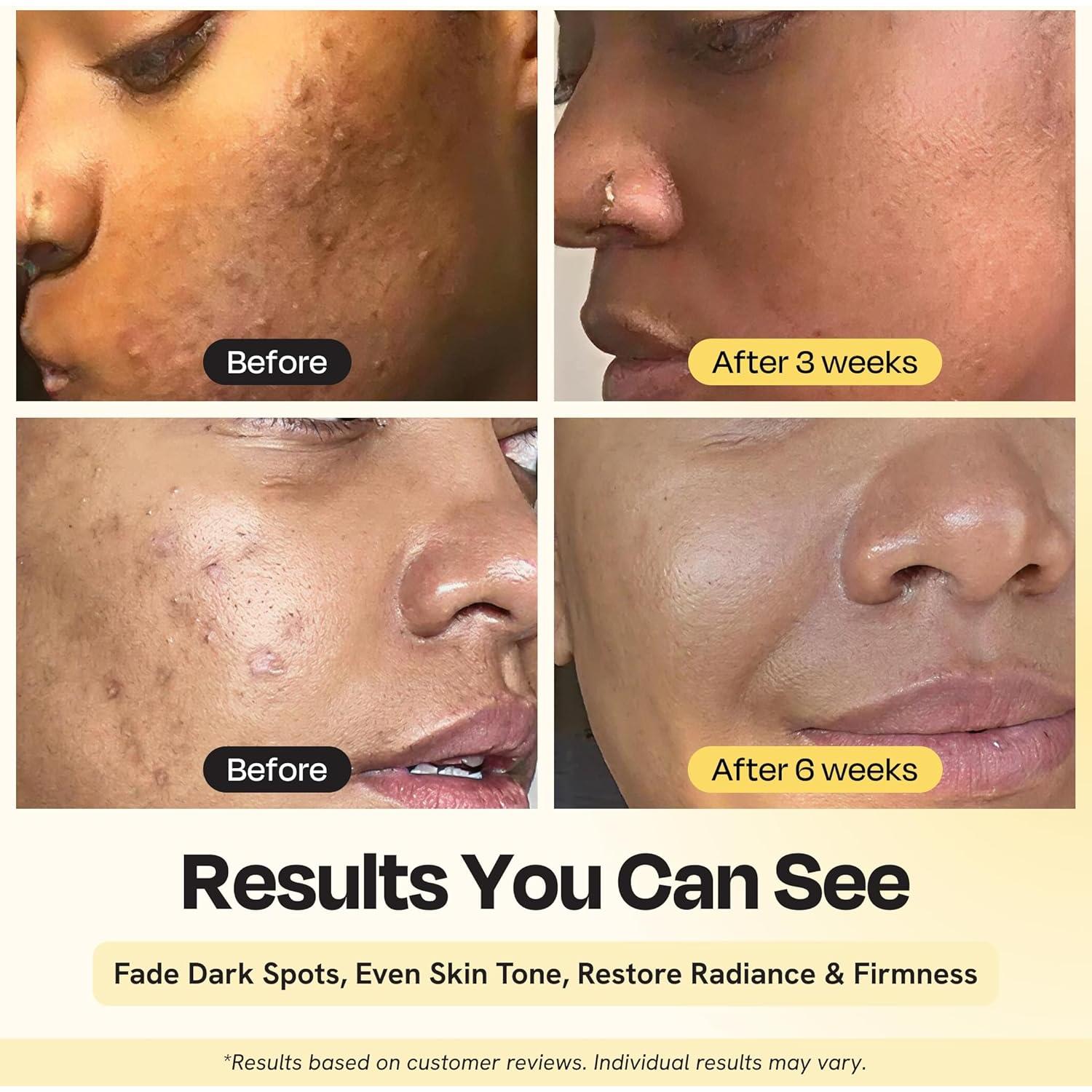 Suero Facial Iluminador Gleamin 15% Vitamina C 29.57 ml