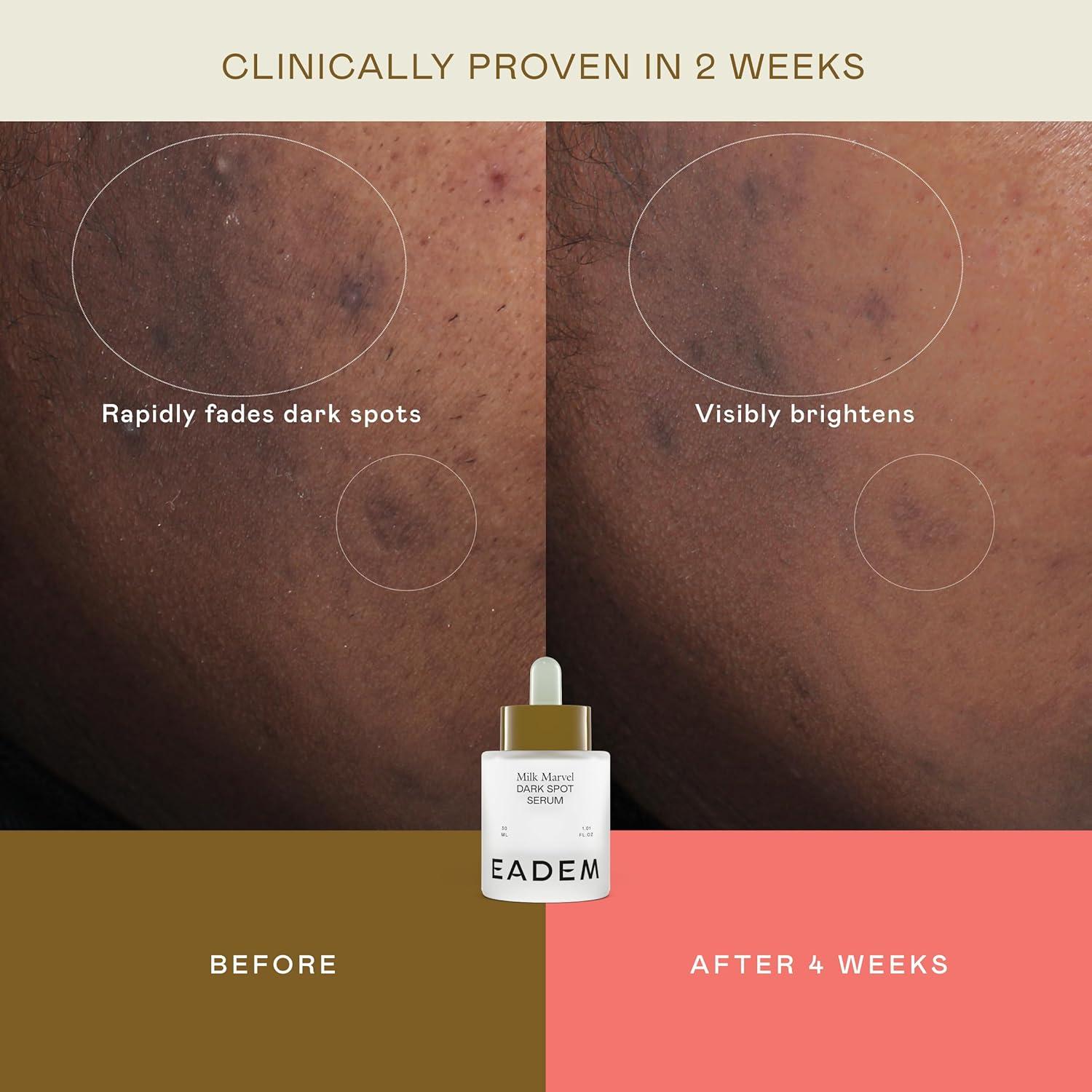 Suero Facial Milk Marvel Vitamina C y Niacinamida 28.35 g