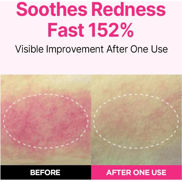 Suero ISOI Rosy Glow Duo + Parches Ojos Hidratantes