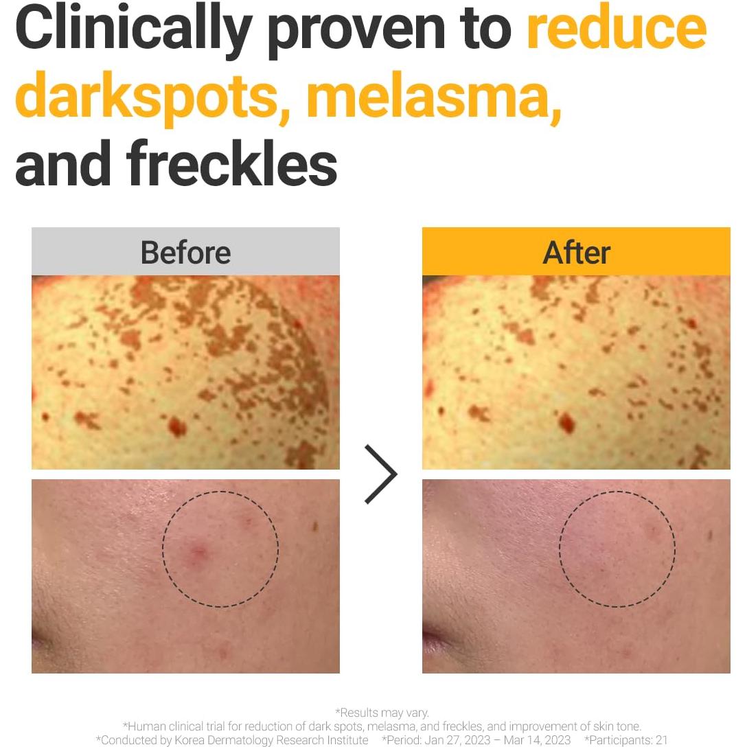 Suero Facial Rovectin Vitamina C 30 ml - Anti Manchas Oscuras