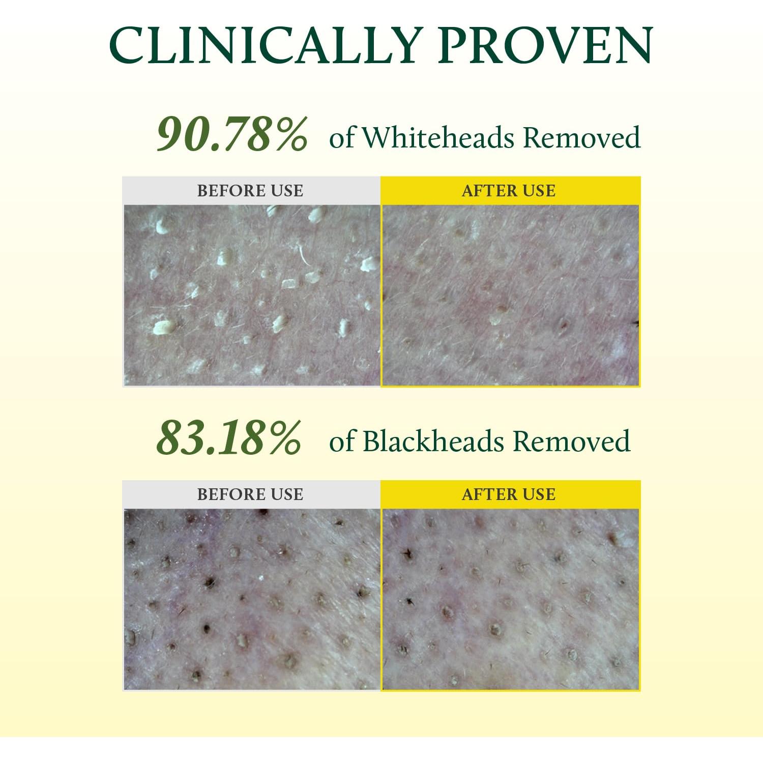 YADAH Aceite Limpiador Facial Profundo 200 ml - Cuidado K-Beauty