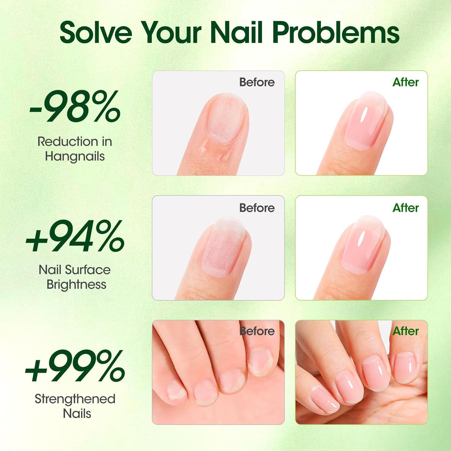 Aceite para Cutículas Gellen 10ml - Crecimiento y Fortalecimiento