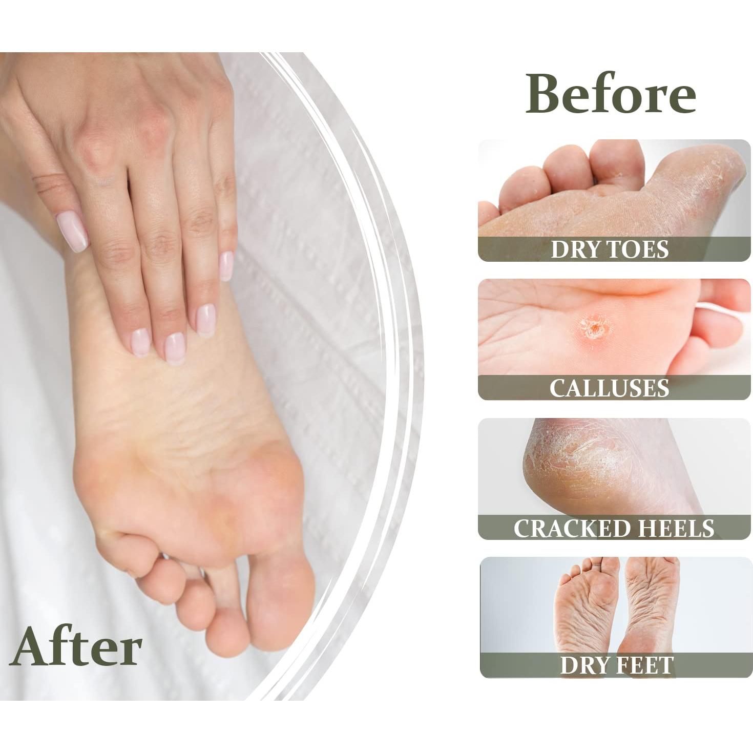 Crema para Pies Secos y Agrietados Vollare 100g - Urea y Aceite de Oliva