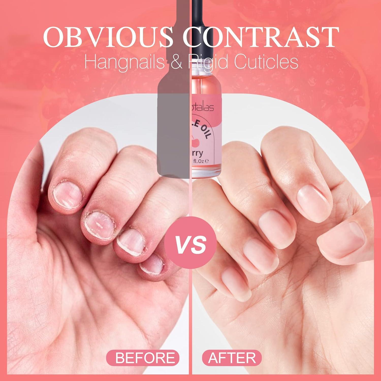 Aceite para Cutículas Foriotalas 15ml Jojoba Cereza Hidratante