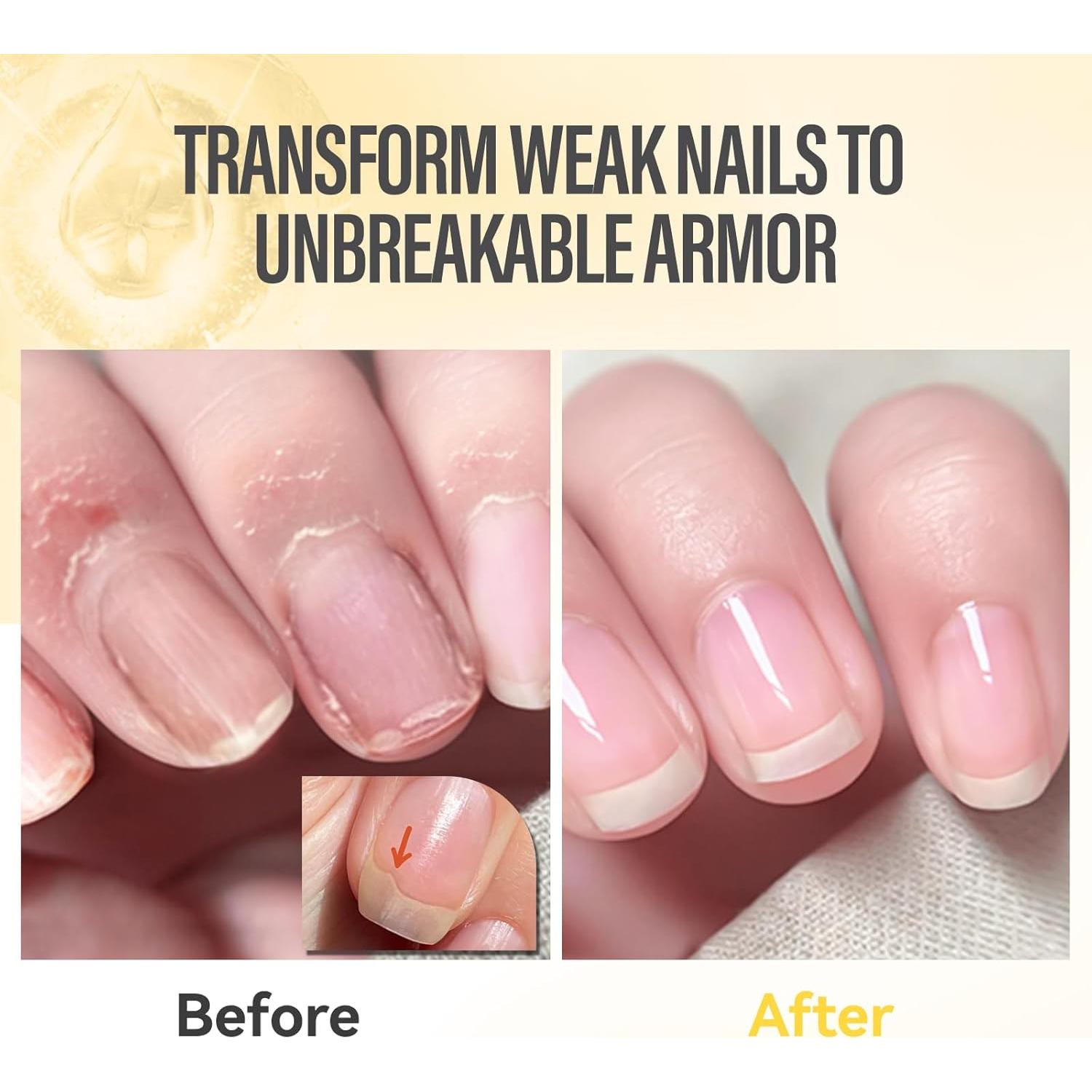 Aceite para Uñas CHUCHU con Jojoba y Vitamina E - 50ml