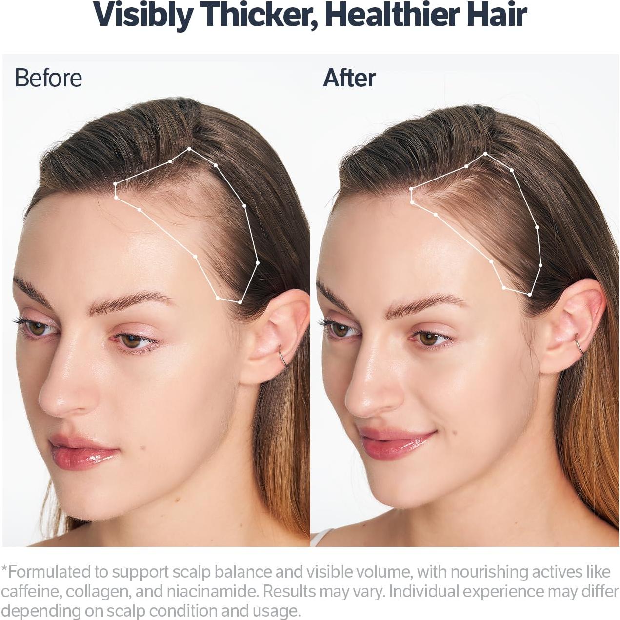 Suero de Crecimiento Capilar Sungboon con Colágeno y Biotina 14.79 ml