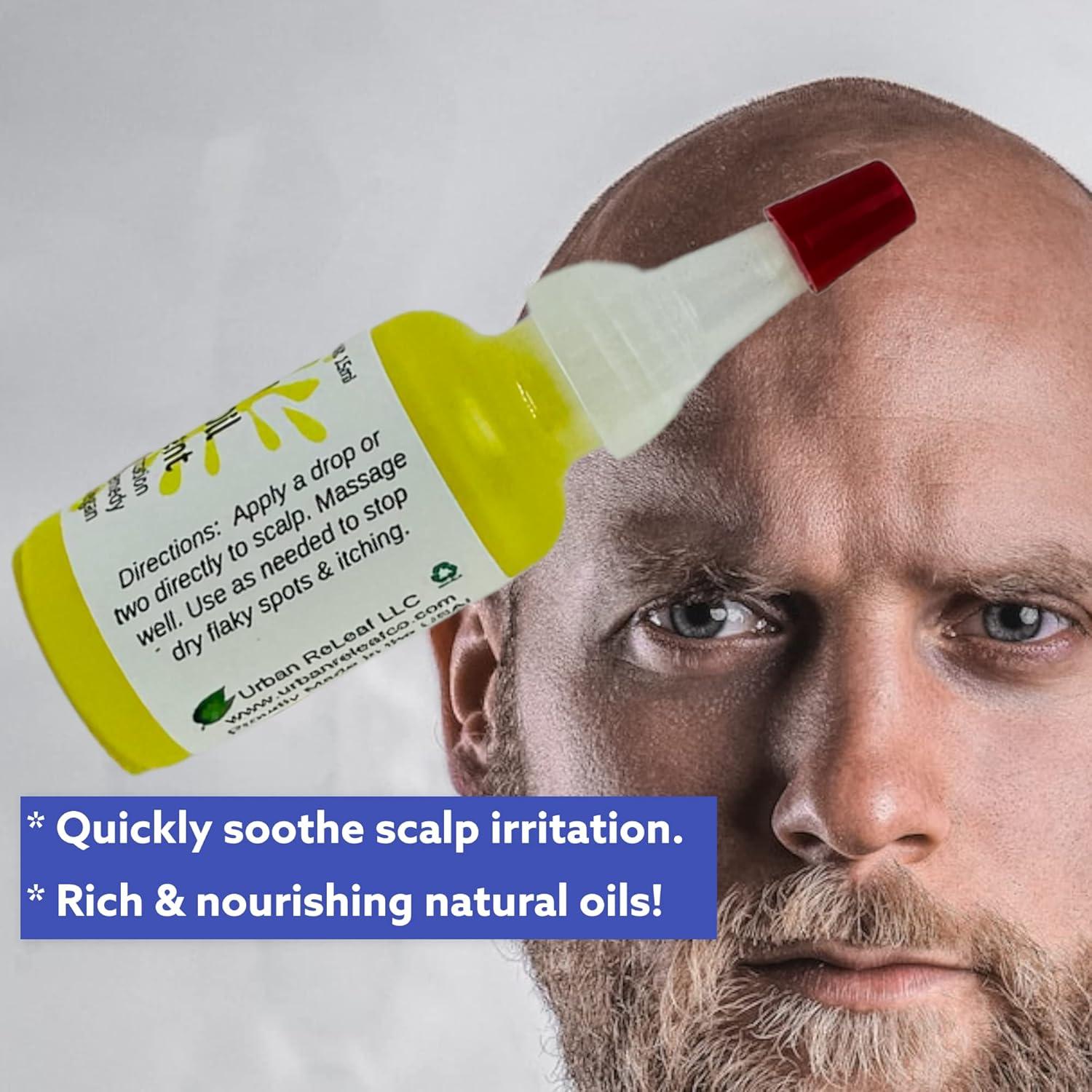 Aceite para Cuero Cabelludo Itch Urban ReLeaf 15 ml Alivio Picazón