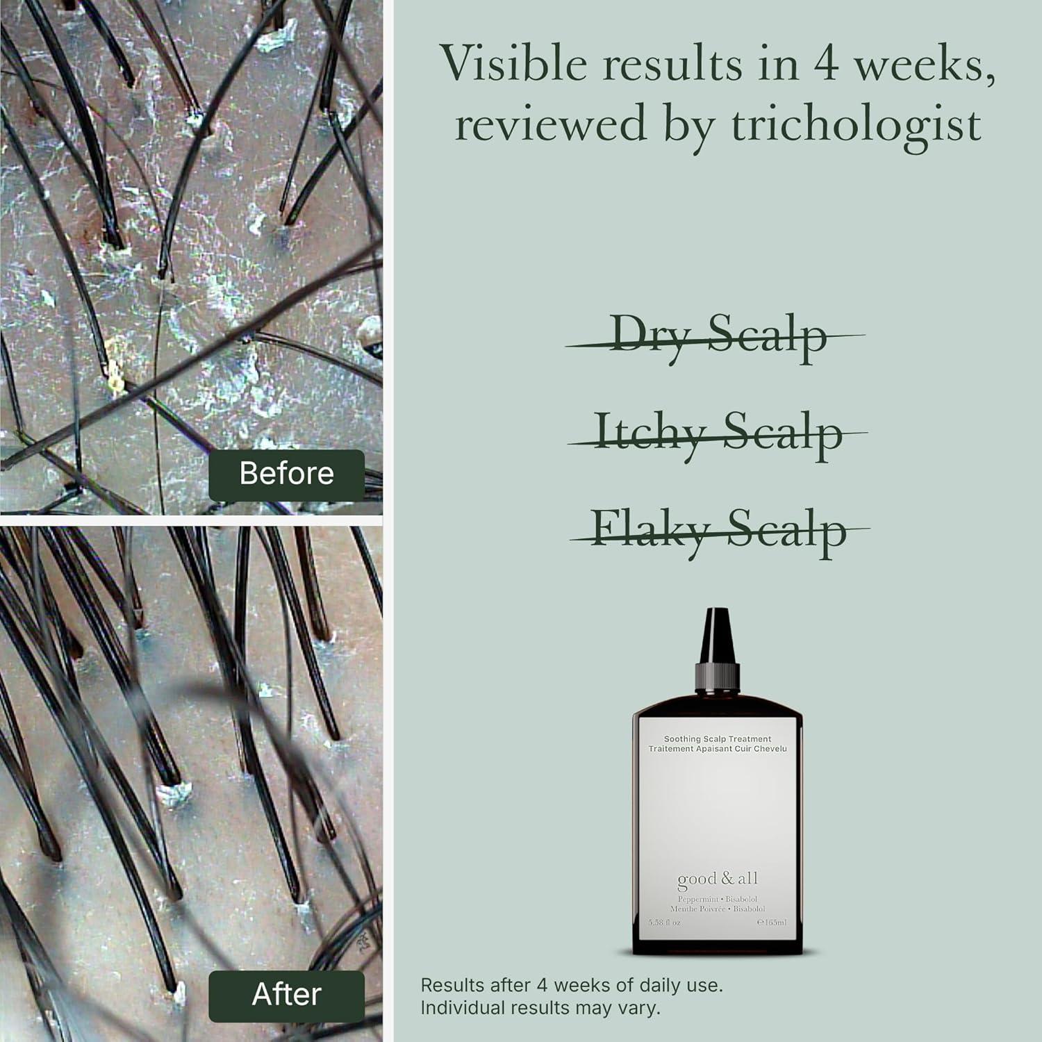 Good&All Tratamiento Cuero Cabelludo Seco 164 ml - Sin Enjuague