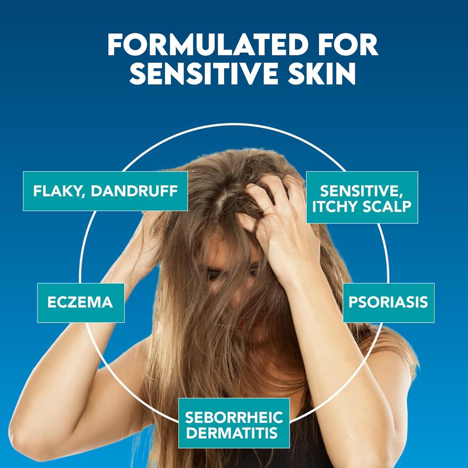 Suu Balm Spray Hidratante Anticaspa 40 ml - Alivio Picazón