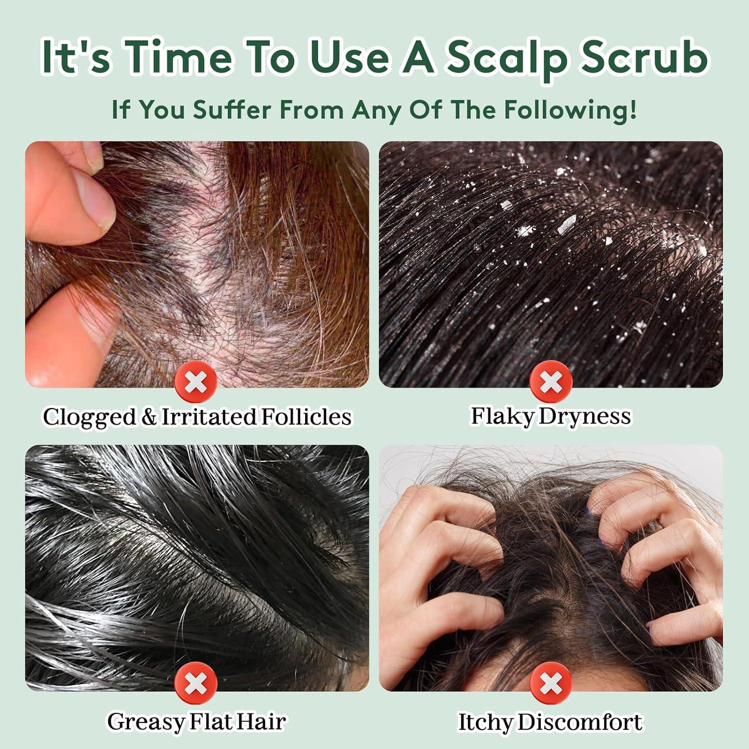 Exfoliante para Cuero Cabelludo Femeni 260g - Biotina, Romero y Menta