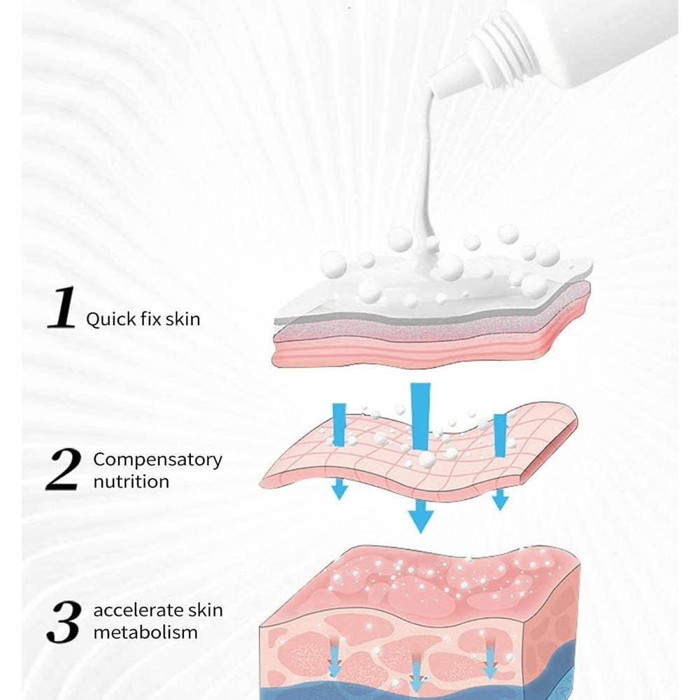 Crema para el Acné Onkessy 15 ml - Control de Aceite y Espinillas