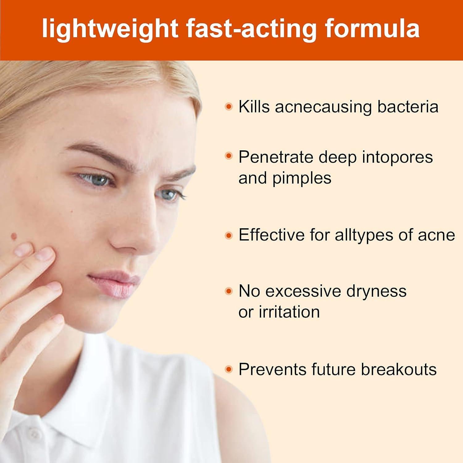 Crema Tratamiento Acné Localizado 30g - Hidratante Anti-acné