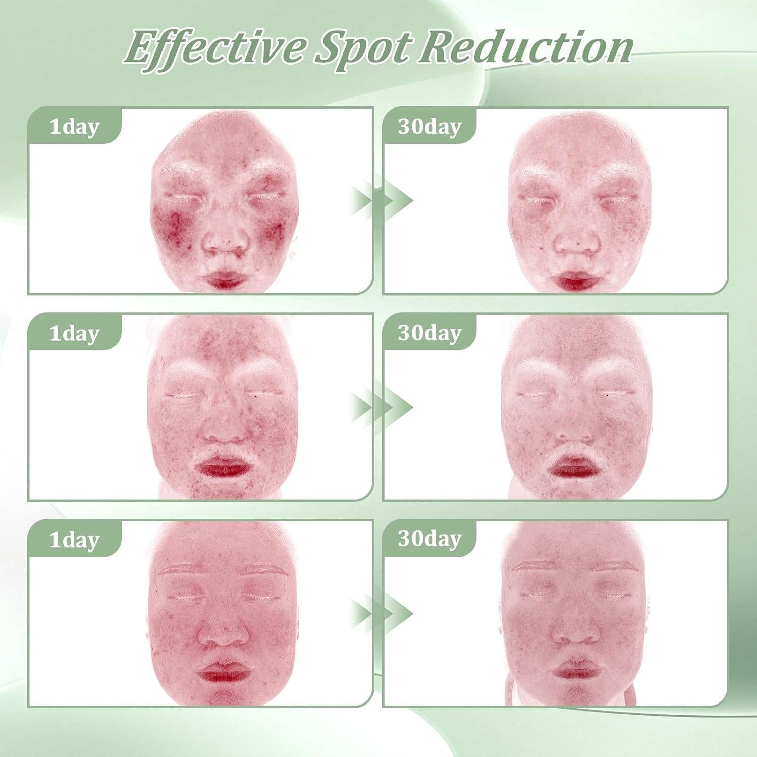 Crema Tratamiento Acné Bablabear 30g 2% Ácido Salicílico