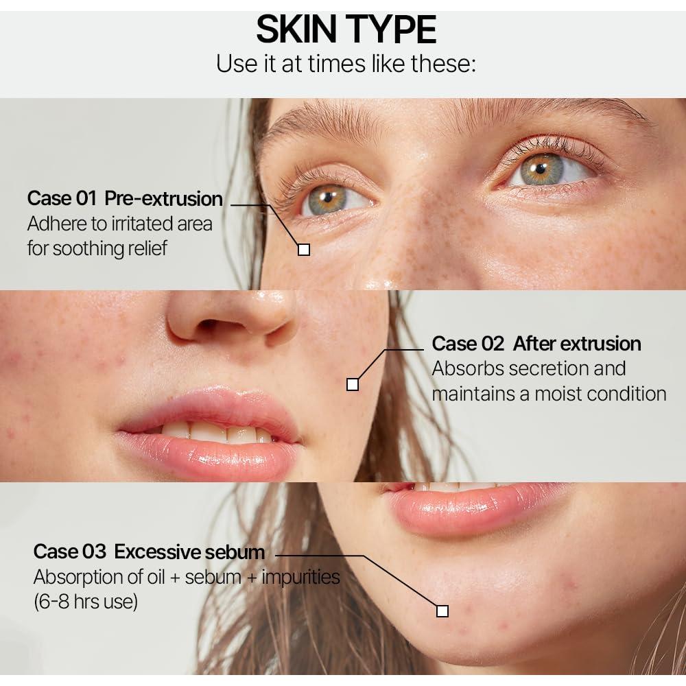 Parche Hidrocoloide Parnell Cicamanu para Acné - 68 Unidades