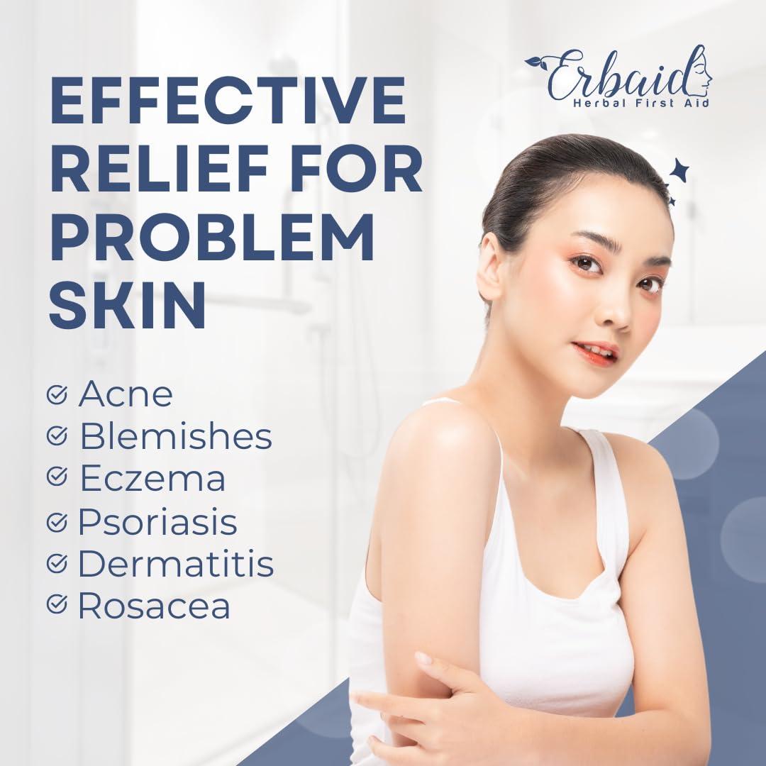 Jabón de Zinc Piritiona Erbaid 113g - Para Acné y Eccema