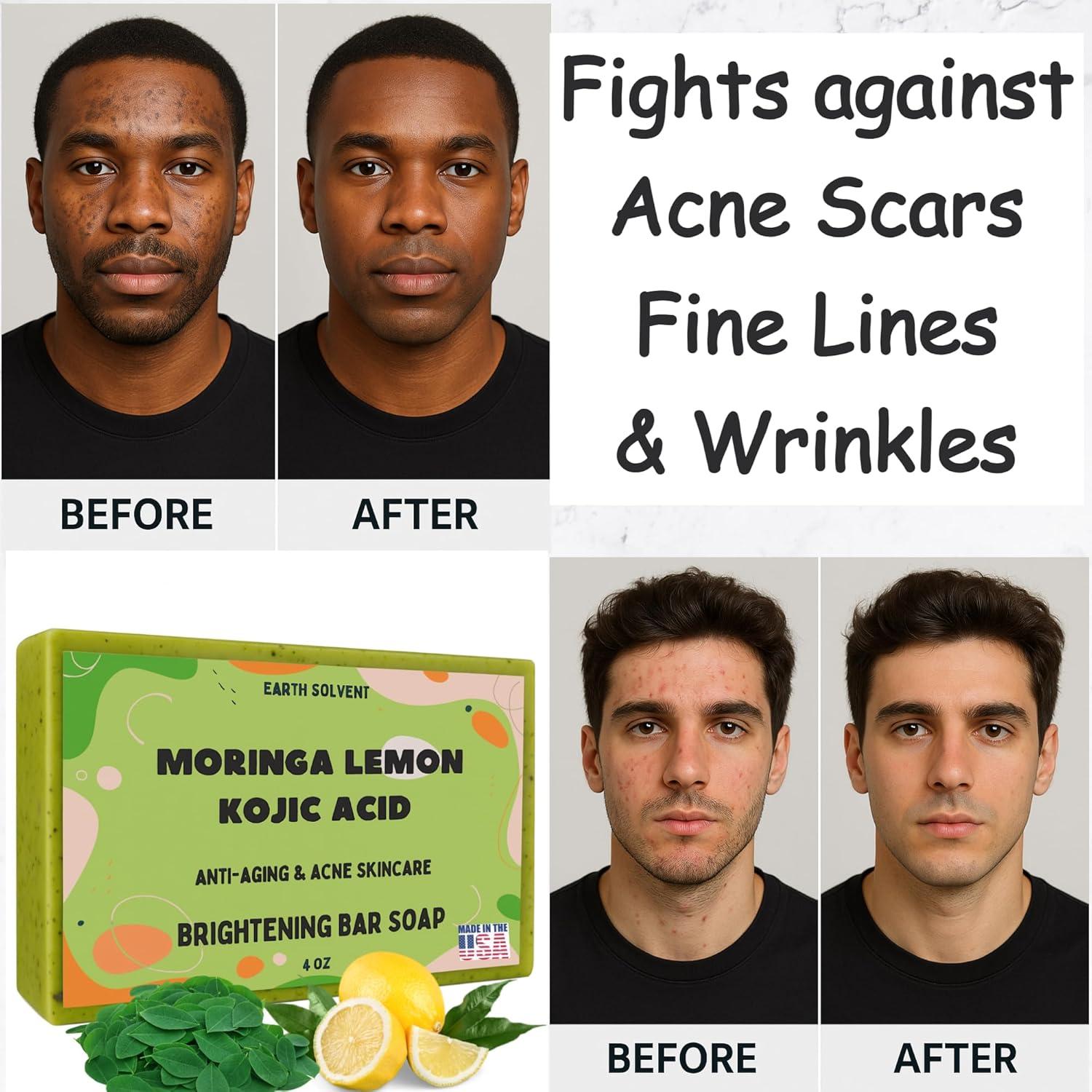 Jabón Aclarador de Moringa y Ácido Kojico Earth Solvent 3 Unidades 113g