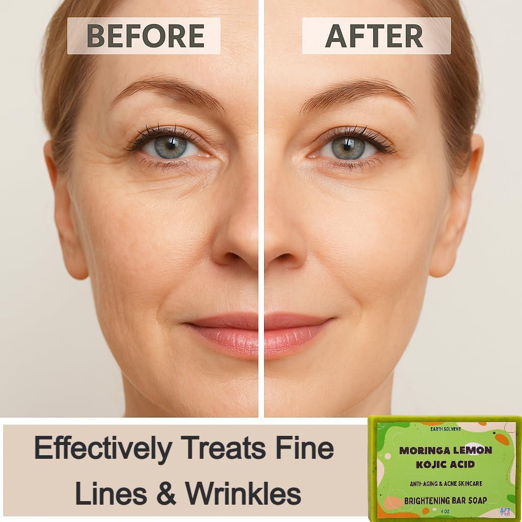 Jabón Aclarador de Moringa y Ácido Kojico Earth Solvent 3 Unidades 113g