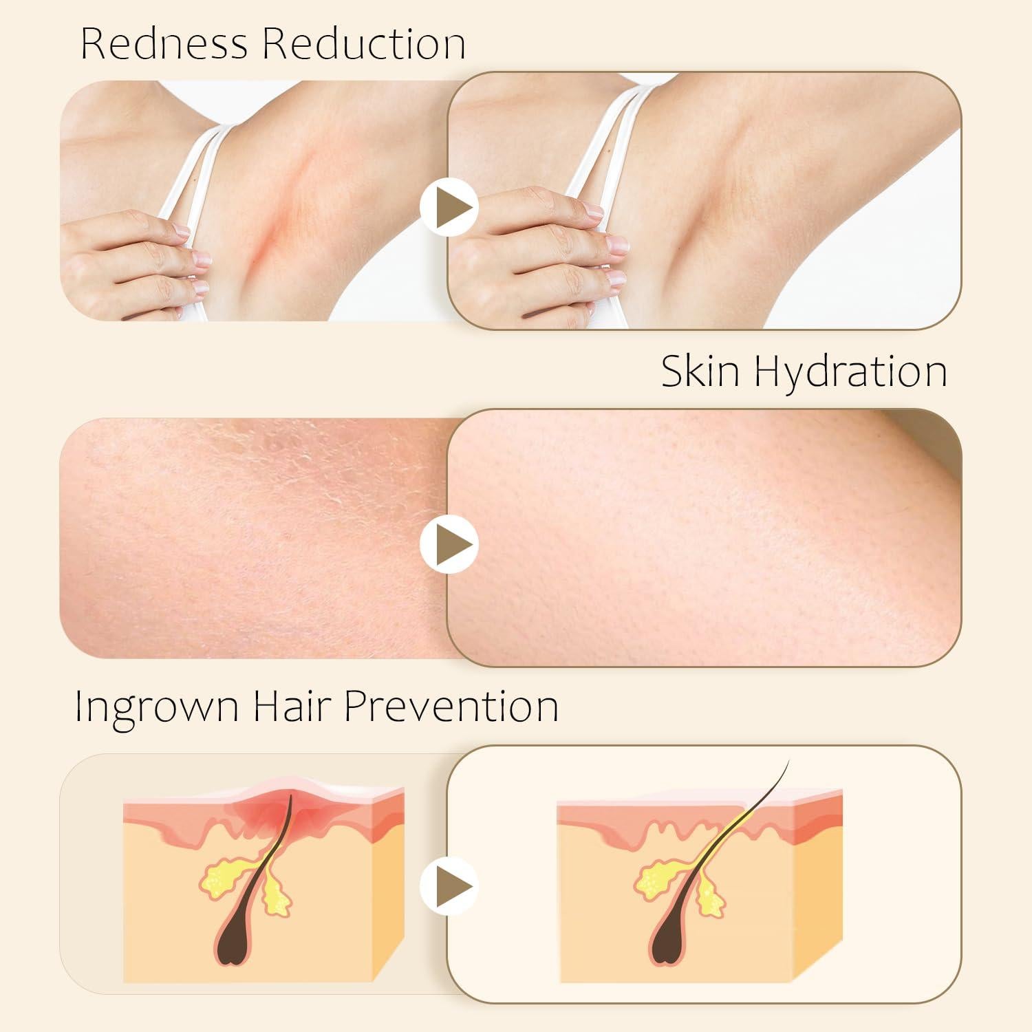 Aceite After Shave Furré 30 ml - Tratamiento Vellos Encarnados