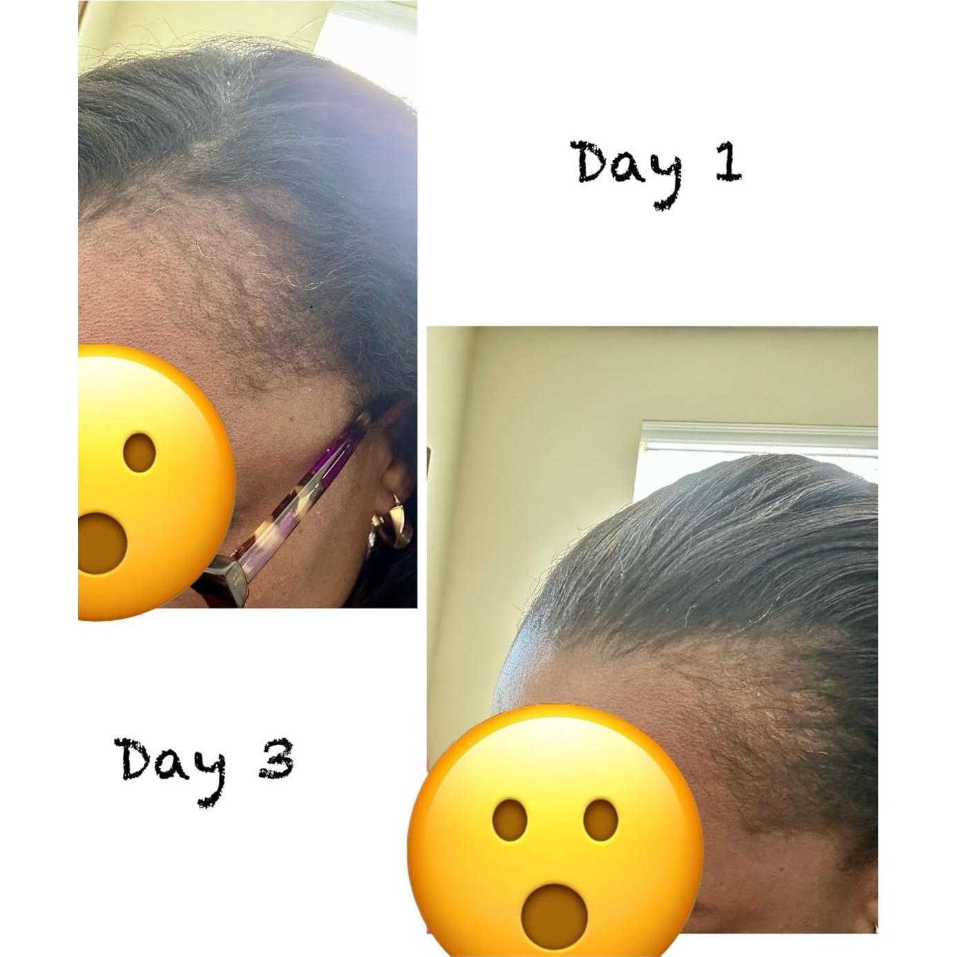 Aceite Herbal para el Cabello 19-en-1 - Crecimiento y Fortalecimiento