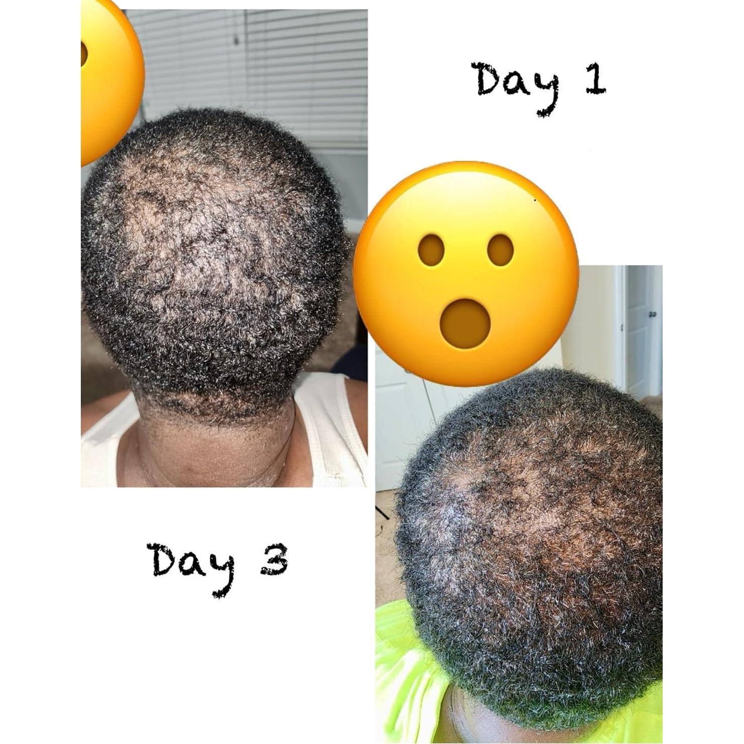 Aceite Herbal para el Cabello 19-en-1 - Crecimiento y Fortalecimiento