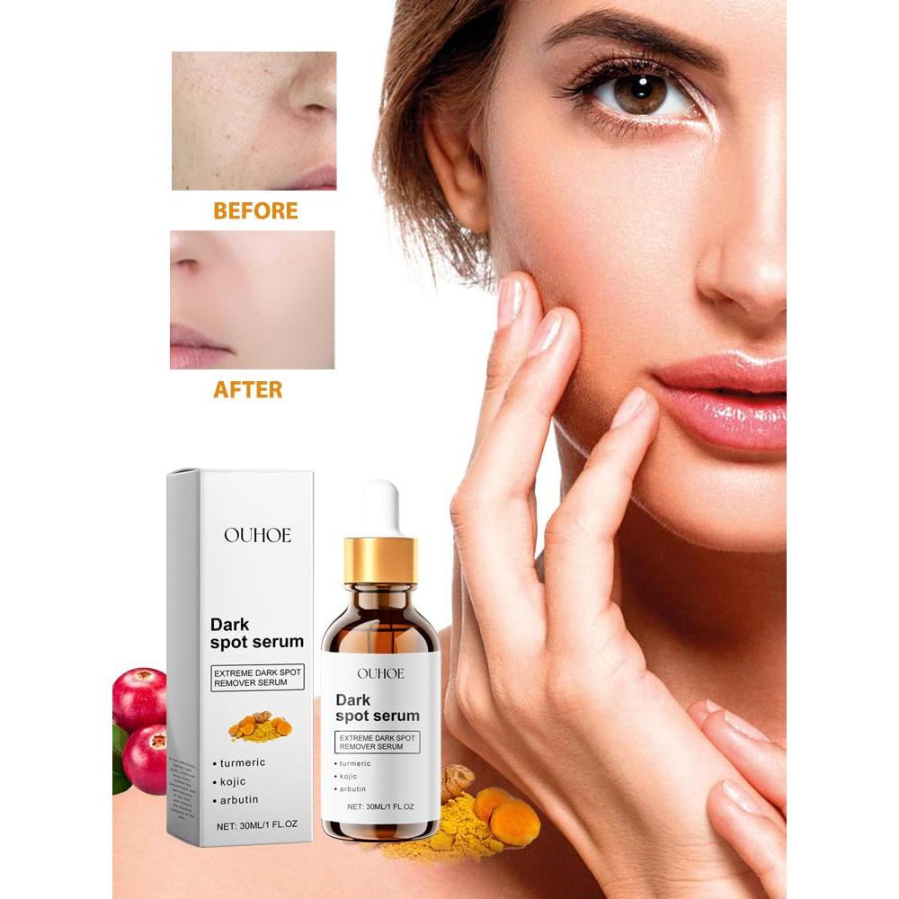 Suero Iluminador de Ácido Kójico y Cúrcuma 29.57 ml