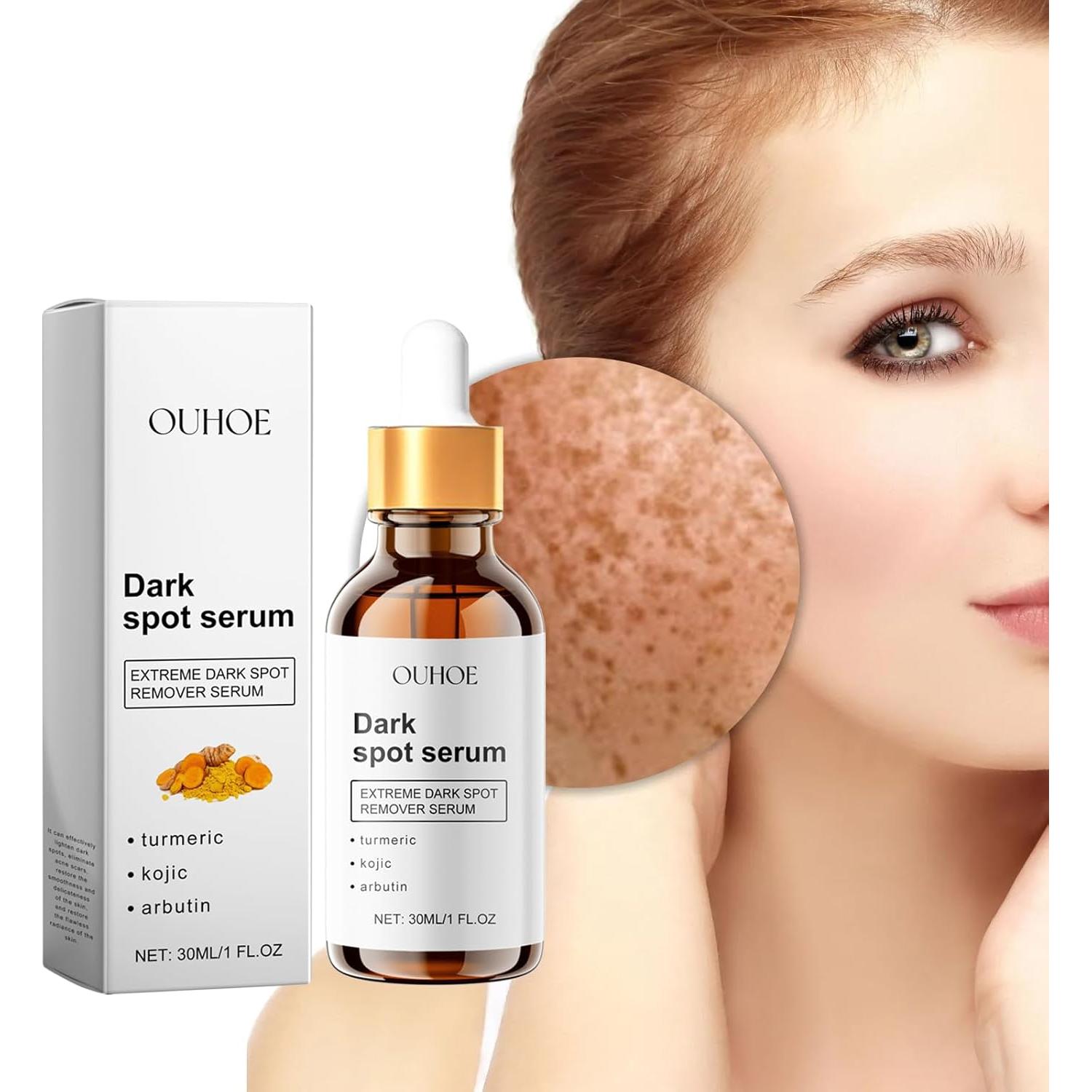 Suero Iluminador de Ácido Kójico y Cúrcuma 29.57 ml