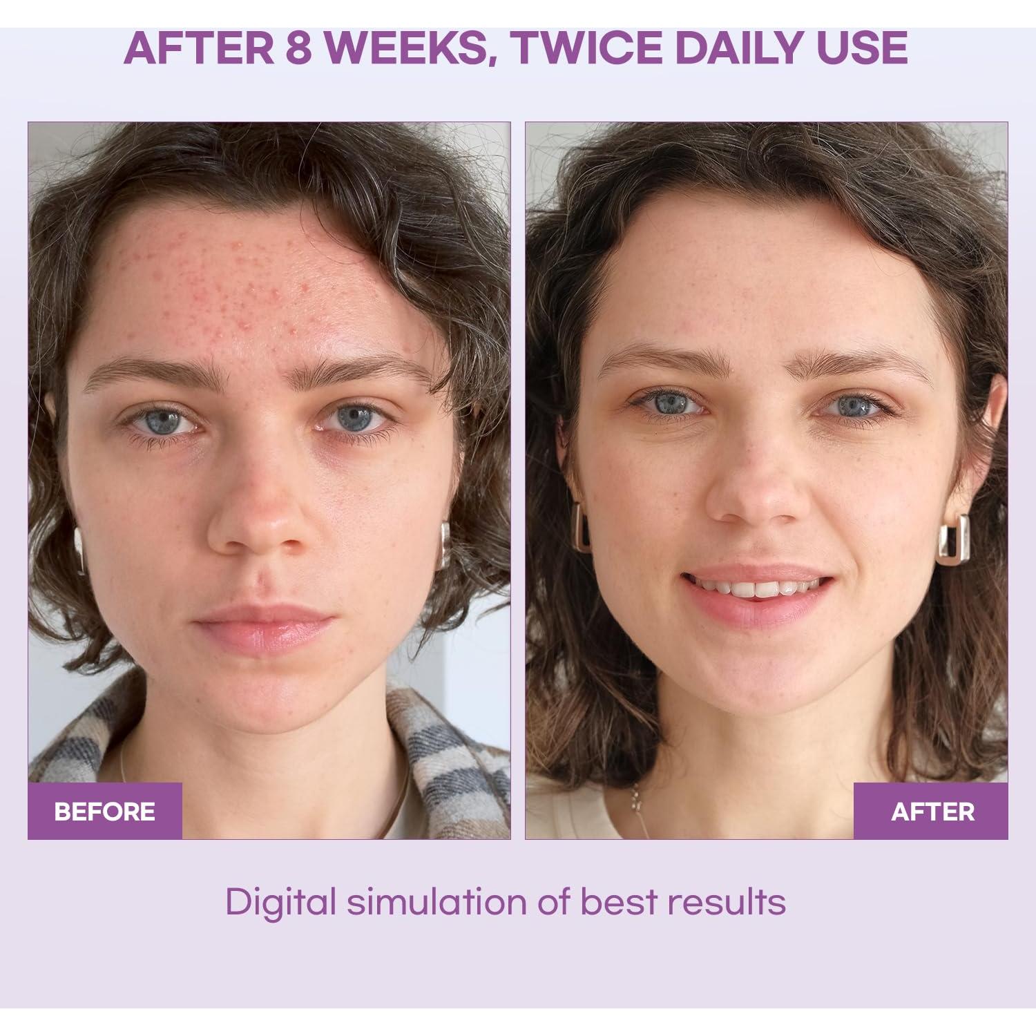 Suero Natural Vine para Manchas Oscuras 30 mL - Hidratante