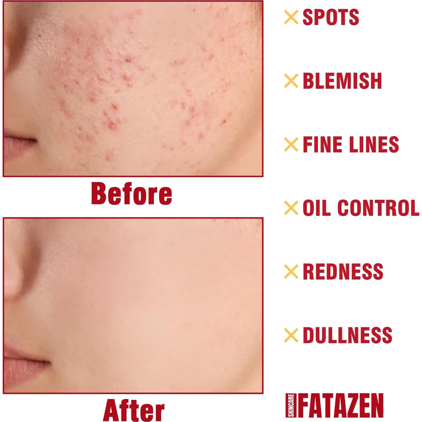 Suero Facial de Cúrcuma FATAZEN 80g - Antienvejecimiento y Calmante