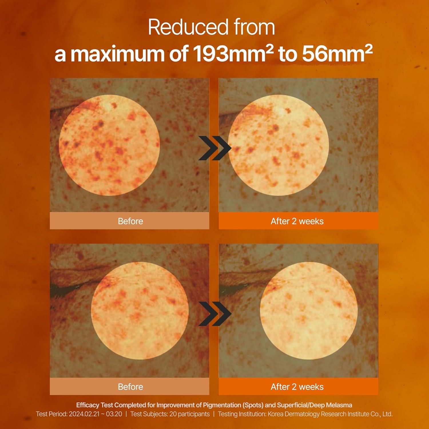 Suero Tonificante para Manchas de Café y Crema Conceal Banana - 10% Niacinamida