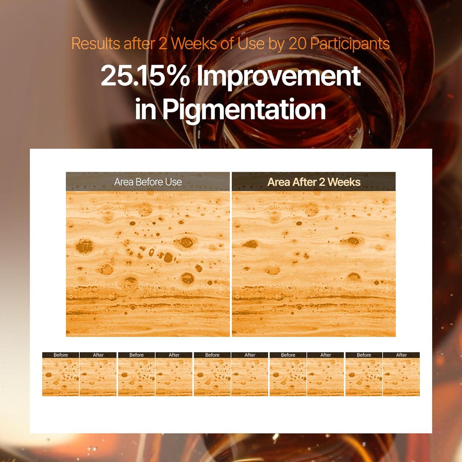 Suero Tonificante para Manchas de Café y Crema Conceal Banana - 10% Niacinamida