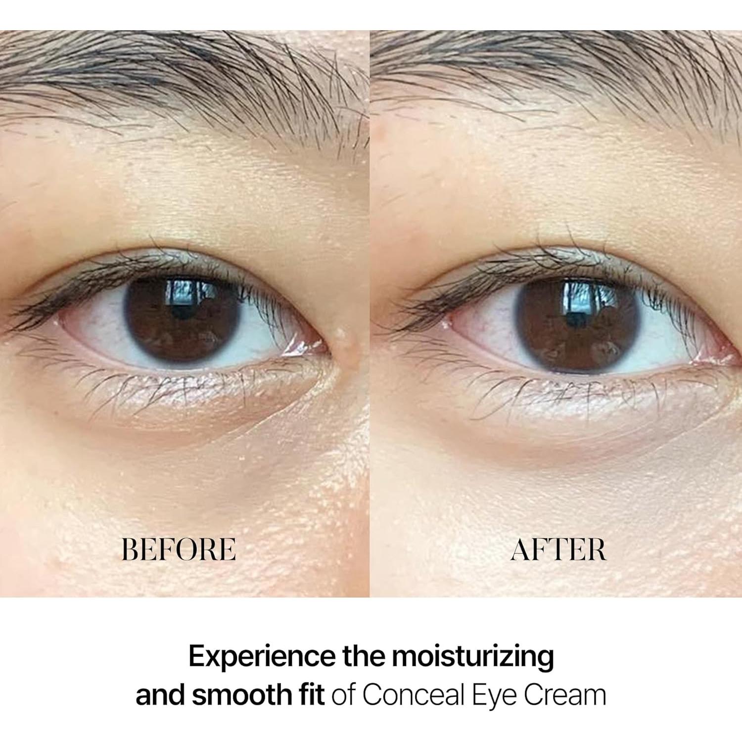 Suero Tonificante para Manchas de Café y Crema Conceal Banana - 10% Niacinamida