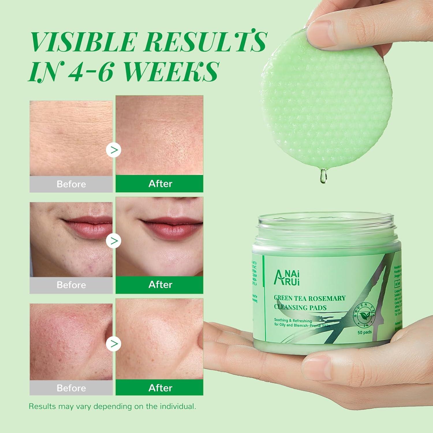 Almohadillas Limpiadoras ANAI RUI con Té Verde y Romero 50pcs