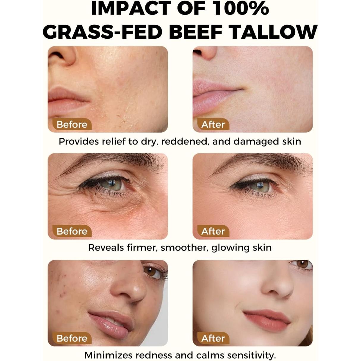 Crema Hidratante Natural Lopeie 120g - Grasa de Res con Miel