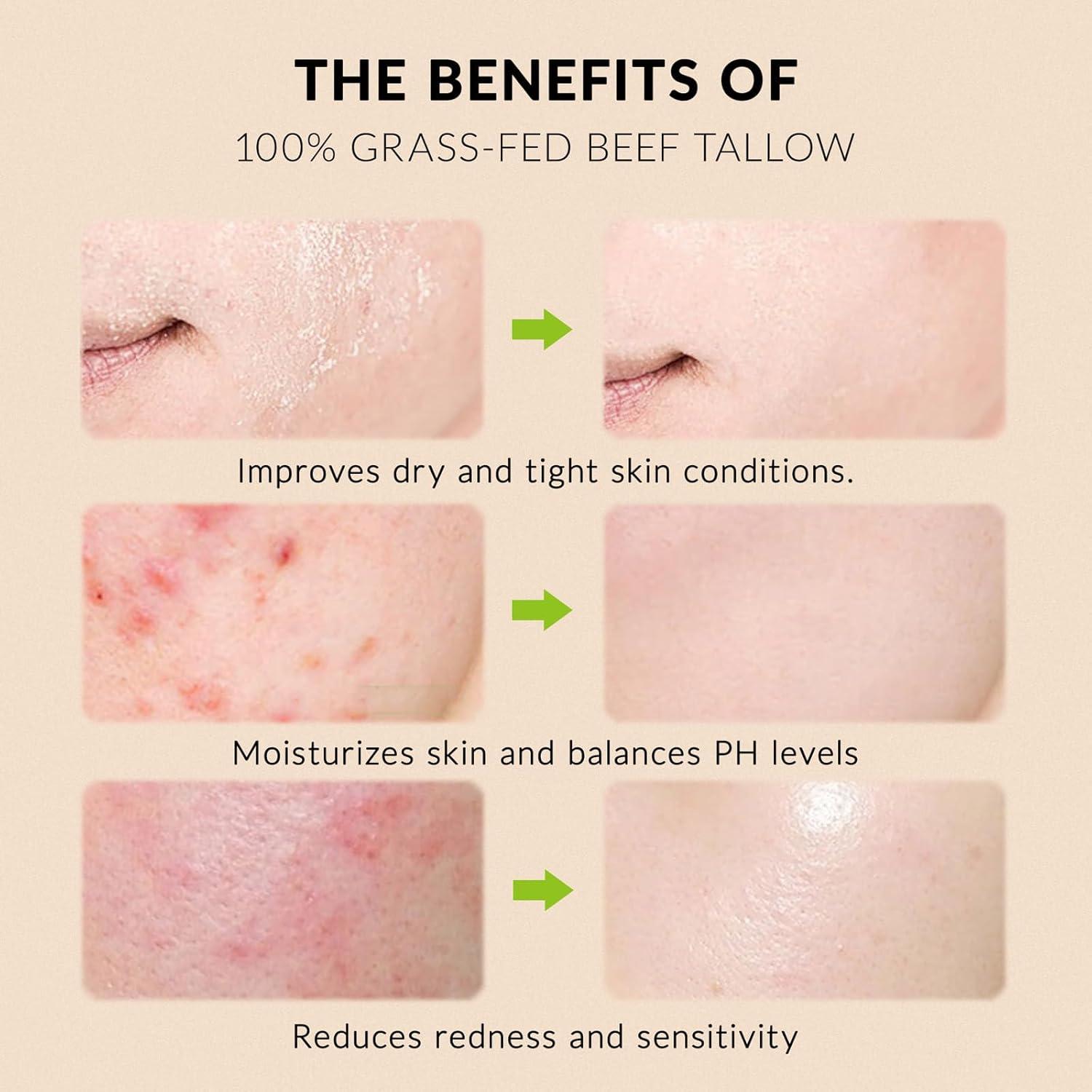 Bálsamo Hidratante Natural Lymznus 113.4 g - Grasa de Res y Miel