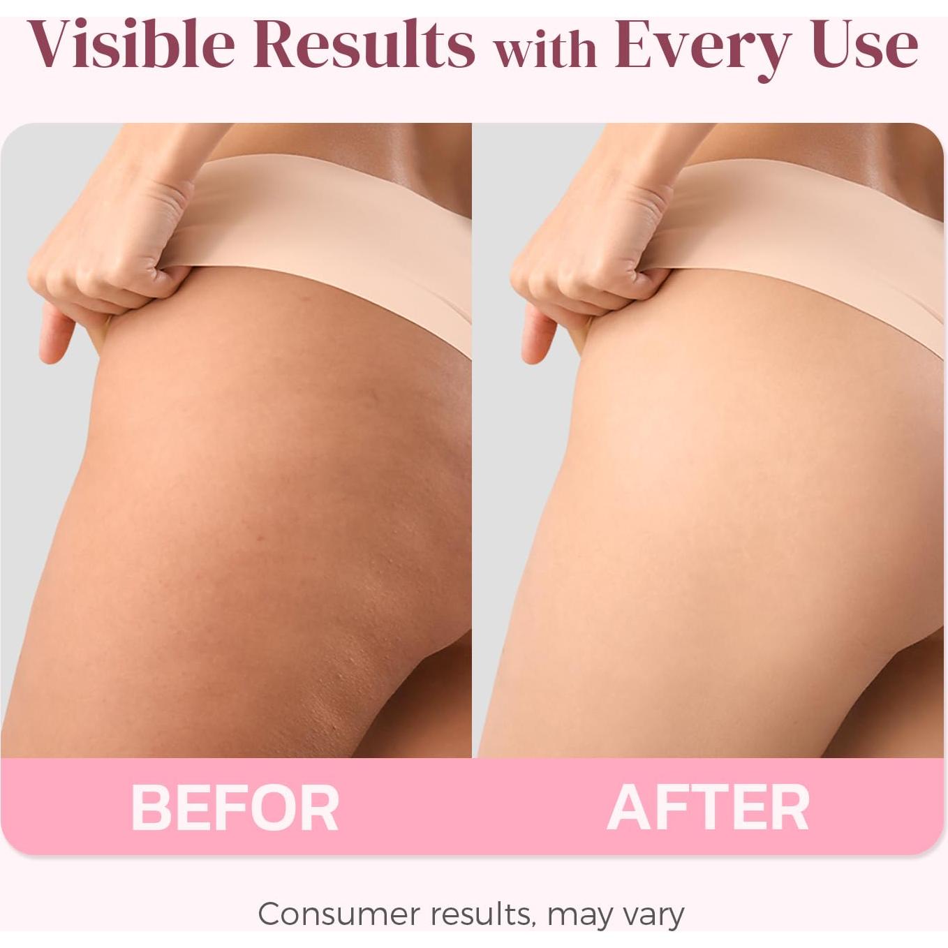 Crema Anticelulitis Reafirmante LIFTONIN 109.8 ml - Solivetta