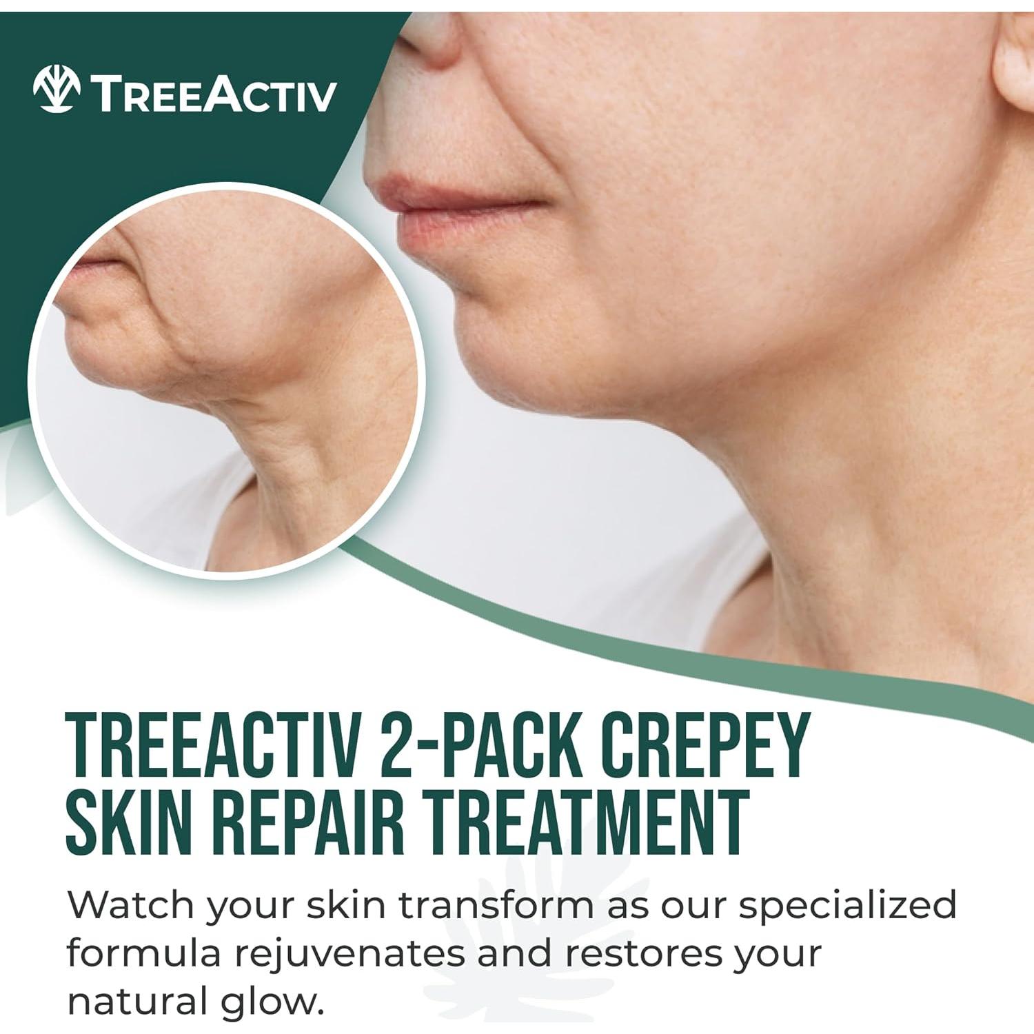 TreeActiv Crema Reafirmante para Piel Crepey - 2 Unidades - Ácido Hialurónico