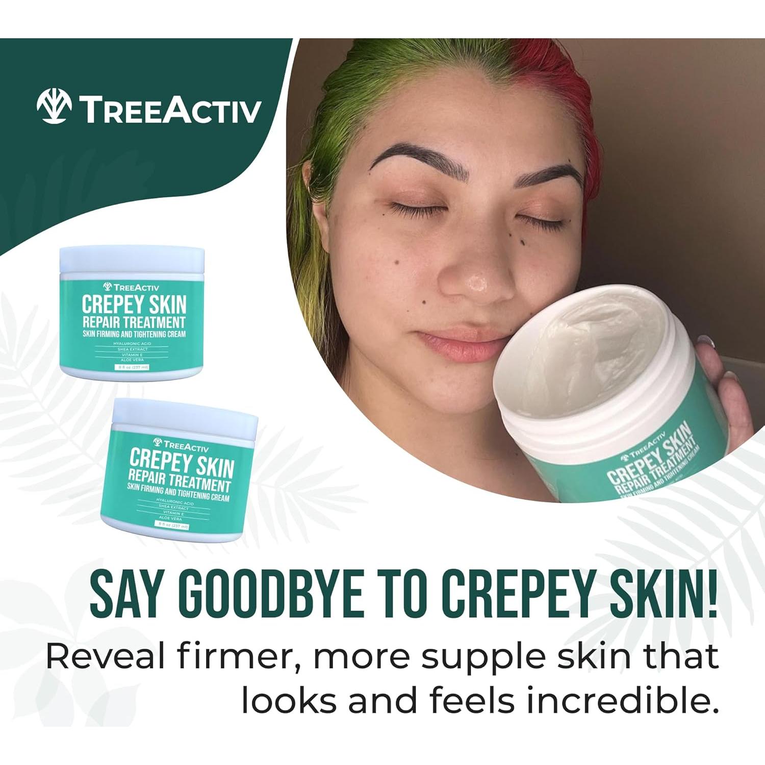 TreeActiv Crema Reafirmante para Piel Crepey - 2 Unidades - Ácido Hialurónico
