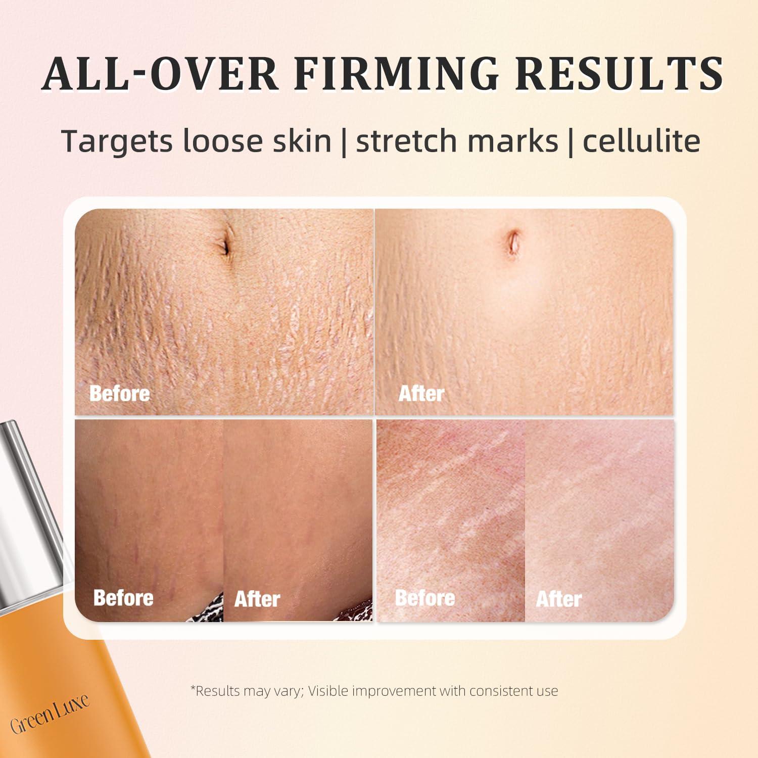 Crema Reafirmante Green Luxe 290g para Abdomen y Muslos